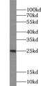 Ubiquitin Conjugating Enzyme E2 T antibody, FNab09185, FineTest, Western Blot image 