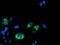 1-Acylglycerol-3-Phosphate O-Acyltransferase 5 antibody, M10870, Boster Biological Technology, Immunofluorescence image 