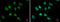 Myocyte Enhancer Factor 2B antibody, GTX119810, GeneTex, Immunocytochemistry image 