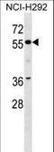 Zinc Finger Protein 512 antibody, LS-C160891, Lifespan Biosciences, Western Blot image 