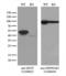 Keratin 8 antibody, LS-C796663, Lifespan Biosciences, Western Blot image 