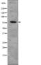 Tumor Protein P73 antibody, PA5-64843, Invitrogen Antibodies, Western Blot image 