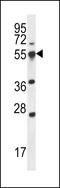 Small ArfGAP2 antibody, LS-C161305, Lifespan Biosciences, Western Blot image 