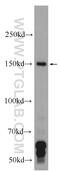 Kinesin-like protein KIF7 antibody, 24693-1-AP, Proteintech Group, Western Blot image 