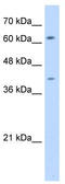 Switching B Cell Complex Subunit SWAP70 antibody, TA339321, Origene, Western Blot image 