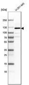 LLGL Scribble Cell Polarity Complex Component 1 antibody, NBP1-84077, Novus Biologicals, Western Blot image 