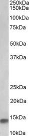 NADH:Ubiquinone Oxidoreductase Subunit A7 antibody, EB11684, Everest Biotech, Western Blot image 