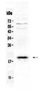 Olfactory Marker Protein antibody, PA5-79769, Invitrogen Antibodies, Western Blot image 
