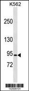 Chloride Voltage-Gated Channel 5 antibody, 60-821, ProSci, Western Blot image 