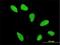 Histone Cluster 2 H2A Family Member A4 antibody, H00008337-M01, Novus Biologicals, Immunocytochemistry image 