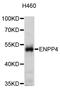 Ectonucleotide Pyrophosphatase/Phosphodiesterase 4 antibody, abx003383, Abbexa, Western Blot image 