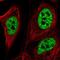 Zinc Finger Protein 621 antibody, NBP2-56492, Novus Biologicals, Immunofluorescence image 