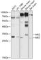 Myelin Protein Zero antibody, GTX55712, GeneTex, Western Blot image 
