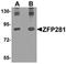 ZFP281 antibody, orb75586, Biorbyt, Western Blot image 