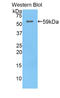 Hepatic lipase antibody, LS-C299081, Lifespan Biosciences, Western Blot image 