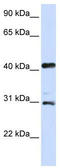 Aurora Kinase A antibody, TA329186, Origene, Western Blot image 