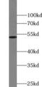 Nuclear Receptor Subfamily 5 Group A Member 1 antibody, FNab05847, FineTest, Western Blot image 