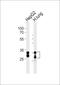Sulfotransferase Family 1A Member 1 antibody, PA5-72202, Invitrogen Antibodies, Western Blot image 
