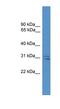 Synaptosome Associated Protein 29 antibody, NBP1-69180, Novus Biologicals, Western Blot image 