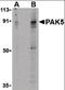 P21 (RAC1) Activated Kinase 5 antibody, orb87341, Biorbyt, Western Blot image 