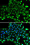 Copper Metabolism Domain Containing 1 antibody, abx005396, Abbexa, Western Blot image 
