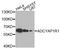 ADCYAP Receptor Type I antibody, A3120, ABclonal Technology, Western Blot image 