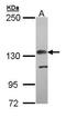 Complement Factor H antibody, GTX100305, GeneTex, Western Blot image 