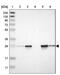 Peroxiredoxin 6 antibody, NBP1-90332, Novus Biologicals, Western Blot image 