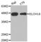 ELOVL Fatty Acid Elongase 6 antibody, abx002510, Abbexa, Western Blot image 