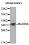 RAD23 Homolog A, Nucleotide Excision Repair Protein antibody, TA332579, Origene, Western Blot image 