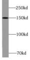 Kinesin-like protein KIF7 antibody, FNab04570, FineTest, Western Blot image 