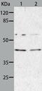 Aminoacyl TRNA Synthetase Complex Interacting Multifunctional Protein 2 antibody, TA322515, Origene, Western Blot image 