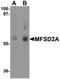 Major facilitator superfamily domain-containing protein 2A antibody, orb94595, Biorbyt, Western Blot image 