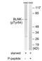 BLNK antibody, GTX24474, GeneTex, Western Blot image 