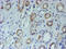 NADH-cytochrome b5 reductase 1 antibody, M11072, Boster Biological Technology, Immunohistochemistry paraffin image 