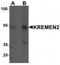 Kremen protein 2 antibody, TA320011, Origene, Western Blot image 