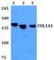 Sodium bicarbonate cotransporter 3 antibody, PA5-75807, Invitrogen Antibodies, Western Blot image 