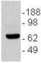 C-C Motif Chemokine Receptor 6 antibody, 14-1969-82, Invitrogen Antibodies, Western Blot image 