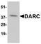 Atypical Chemokine Receptor 1 (Duffy Blood Group) antibody, A04540, Boster Biological Technology, Western Blot image 