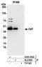Ornithine aminotransferase, mitochondrial antibody, A305-355A, Bethyl Labs, Immunoprecipitation image 