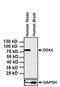DEAD-Box Helicase 4 antibody, MA5-15565, Invitrogen Antibodies, Western Blot image 