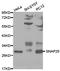 Synaptosome Associated Protein 25 antibody, TA326882, Origene, Western Blot image 