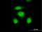 Osteoclast Stimulating Factor 1 antibody, H00026578-B02P, Novus Biologicals, Immunocytochemistry image 