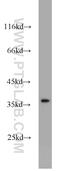 NK2 Homeobox 1 antibody, 21777-1-AP, Proteintech Group, Western Blot image 