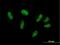 ZFP28 Zinc Finger Protein antibody, H00140612-B01P, Novus Biologicals, Immunocytochemistry image 