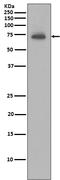 Baculoviral IAP Repeat Containing 3 antibody, M01562, Boster Biological Technology, Western Blot image 