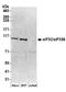 Eukaryotic Translation Initiation Factor 3 Subunit C antibody, A300-377A, Bethyl Labs, Western Blot image 
