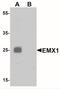Homeobox protein EMX1 antibody, NBP2-41151, Novus Biologicals, Western Blot image 