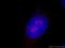 Ribosomal RNA-processing protein 8 antibody, 20129-1-AP, Proteintech Group, Immunofluorescence image 