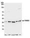 Proteasome 26S Subunit, Non-ATPase 9 antibody, A304-979A, Bethyl Labs, Western Blot image 